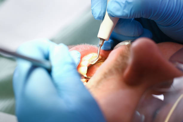 Best Pediatric Emergency Dentist in Vergennes, VT