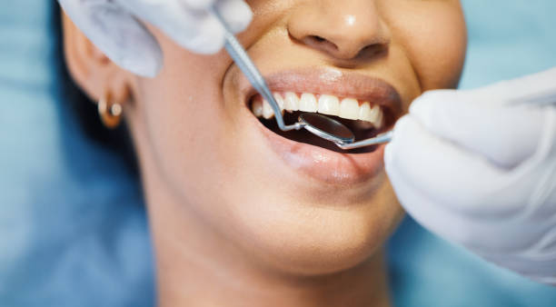 Best After-Hours Dental Trauma Care in Vergennes, VT