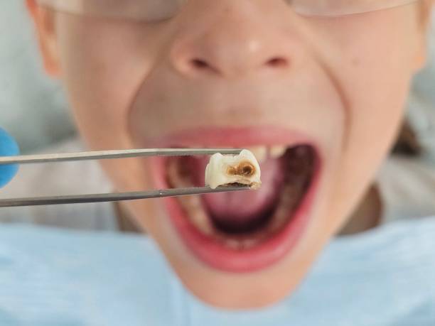 Best Cosmetic Emergency Dentistry in Vergennes, VT